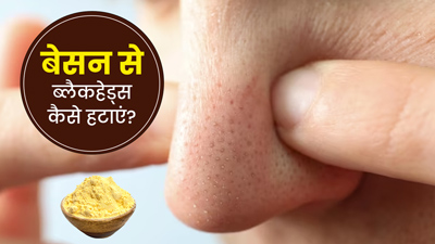 बेसन से ब्लैकहेड्स कैसे हटाएं? जानें 5 तरीके जिनसे एकदम साफ हो जाएगी स्किन