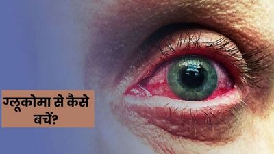 ग्लूकोमा (काला मोतिया) से आंखों को कैसे बचाएं? डॉक्टर्स से जानें टिप्स