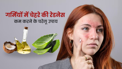गर्मी में आपका चेहरा भी हो जाता है लाल? इन 5 घरेलू उपायों से पाएं इससे छुटकारा