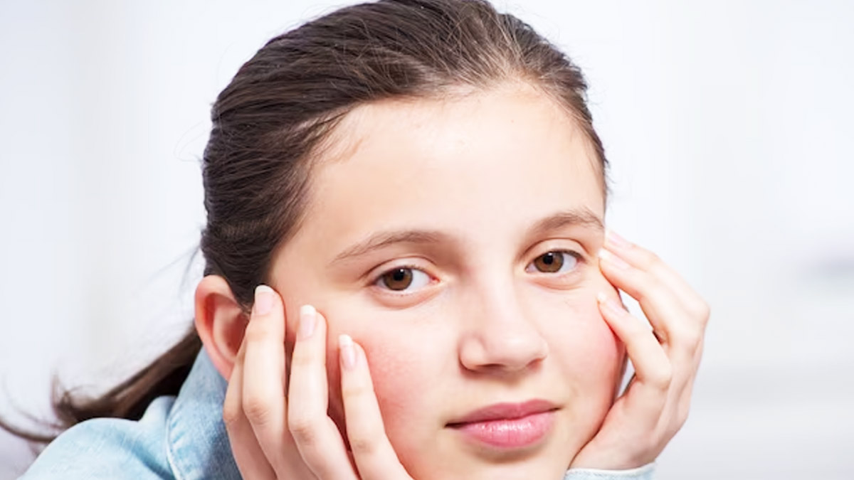 skin care tips for teenagers