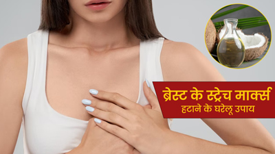 ब्रेस्ट के स्ट्रेच मार्क्स से छुटकारा पाने के लिए ट्राई करें ये 5 घरेलू नुस्खे
