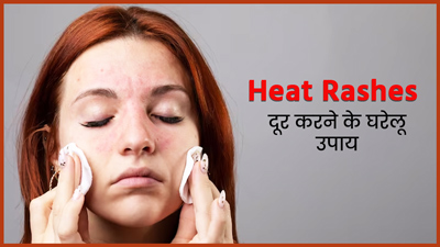 प्रेग्नेंसी में घमौरियां होने पर अपनाएं ये 5 आसान घरेलू उपाय, जल्द मिलेगा छुटकारा