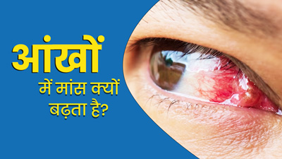 आंख में मांस क्यों बढ़ता है? डॉक्टर से जानें इसके कारण, लक्षण और इलाज