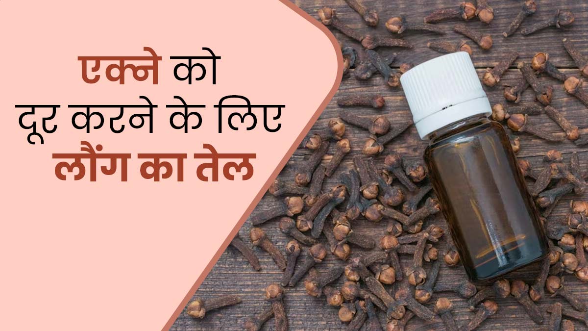मुंहासे की समस्या दूर करने के लिए इस्तेमाल करें लौंग का तेल, जानें इस्तेमाल के तरीके