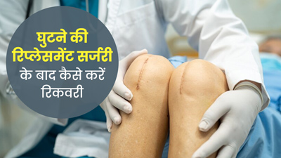 घुटने की रिप्लेसमेंट सर्जरी के बाद कैसे करें जल्दी रिकवरी? जानें डॉक्टर की सलाह