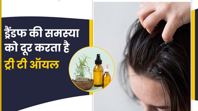 ड्रैंडफ की समस्या दूर करता है ट्री-टी ऑयल, जानें इस्तेमाल करने का तरीका 