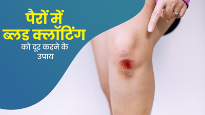 पैरों में खून जमने पर आजमाएं ये 5 घरेलू उपाय, जल्द मिलेगा छुटकारा