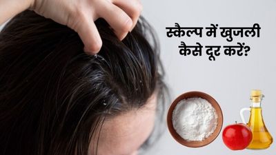 स्कैल्प की खुजली से छुटकारा पाने के लिए ऐसे करें बेकिंग सोडा और सेब के सिरके का इस्तेमाल