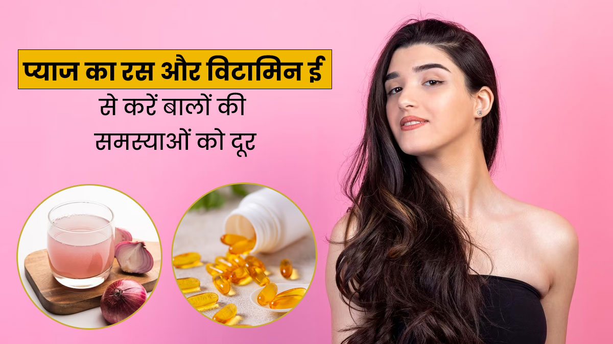बालों के टूटने और झड़ने की समस्या दूर करेगा प्याज का रस और विटामिन ई कैप्सूल, जानें इस्तेमाल का तरीका