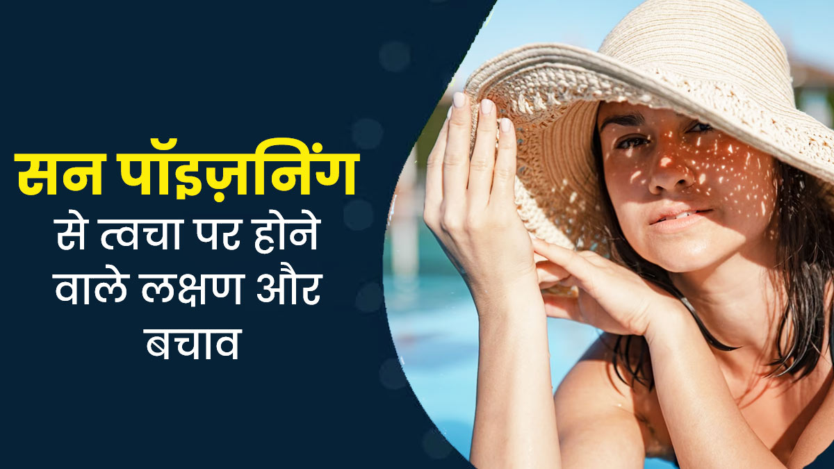 Sun Poisoning: धूप से त्वचा को होते हैं कई नुकसान, जानें इसके लक्षण और बचाव के उपाय
