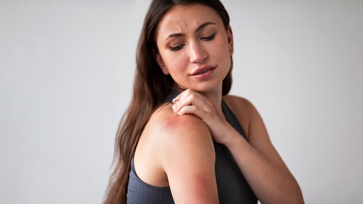 Causes of Summertime Rashes