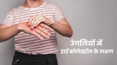 उंगलियों में दिखने वाले ये लक्षण हो सकते हैं हाई कोलेस्ट्रॉल के संकेत