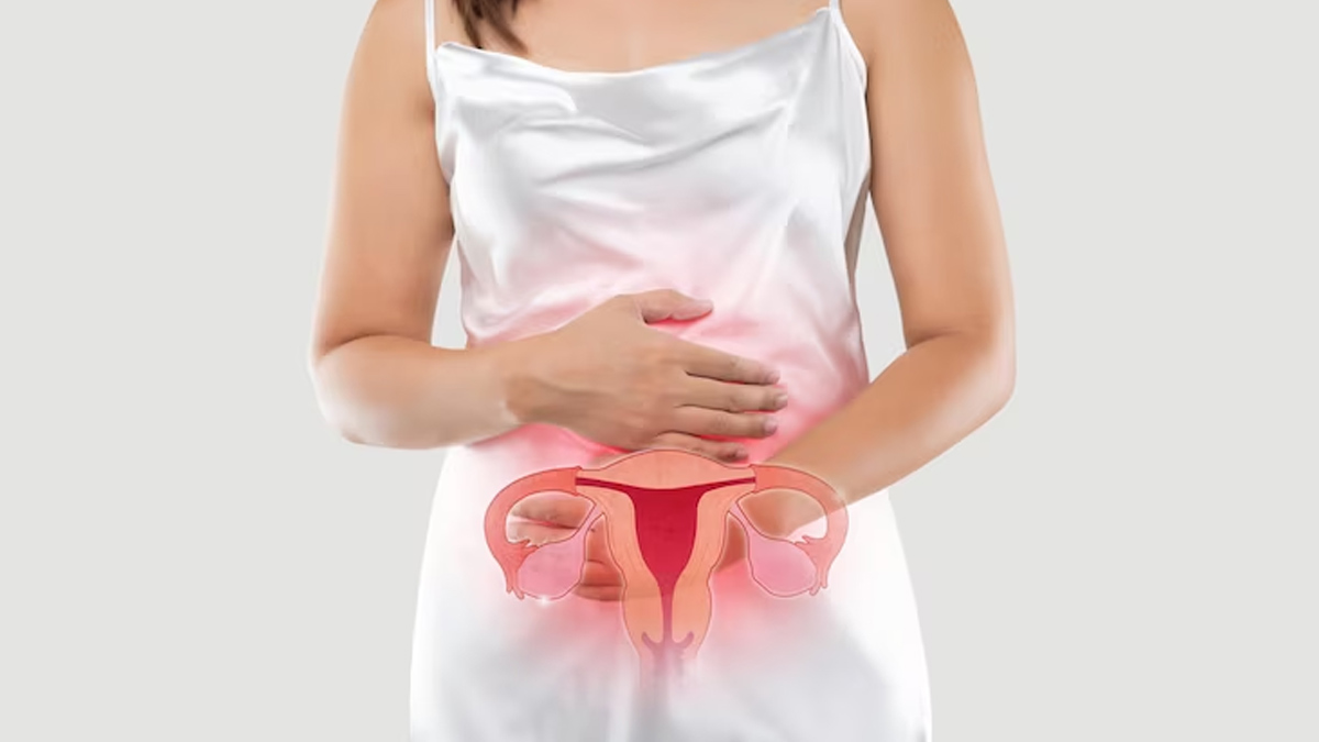 Ayurveda Remedies To Reverse PCOS In Hindi