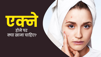 चेहरे पर बार-बार हो जाते हैं मुंहासे? बचाव के ल‍िए खाएं ये 6 हेल्‍दी फूड्स