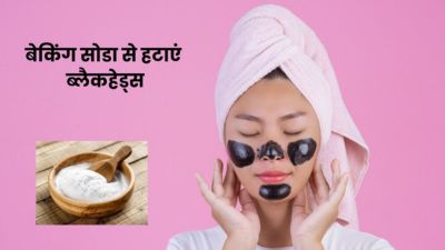 चेहरे पर मौजूद ब्लैकहेड्स को हटाने के लिए करें बेकिंग सोडा का इस्तेमाल, मिलेगा फायदा