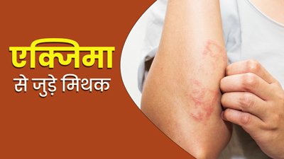 एक्जिमा से जुड़ी इन 6 मिथकों को लोग मानते हैं सही? जानें इनकी सच्चाई