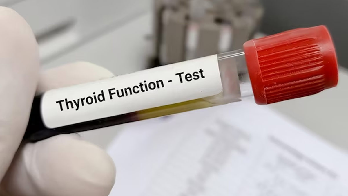thyroid test in pregnancy