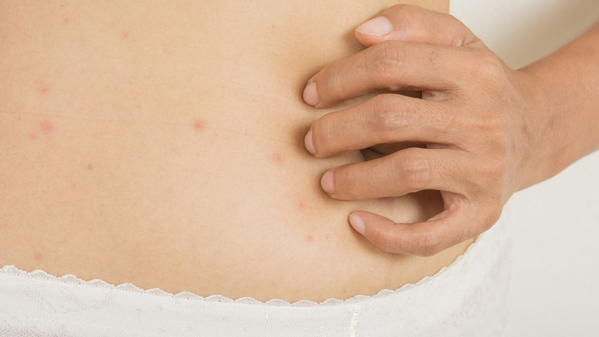 rashes treatment