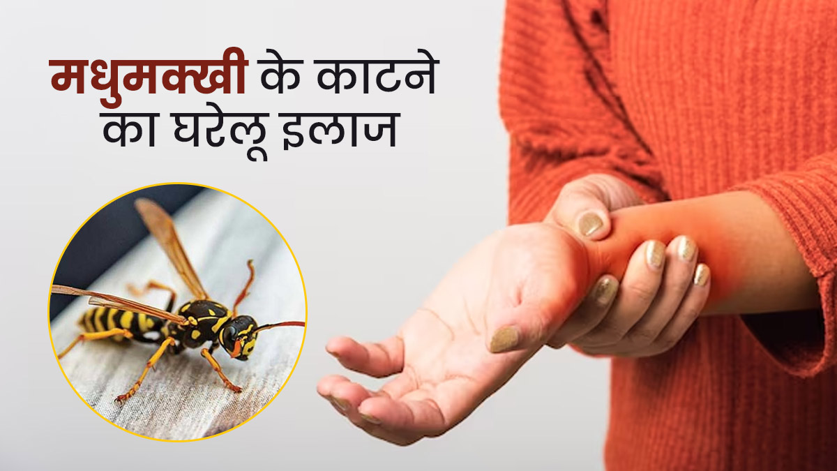 मधुमक्खी के काटने पर करें ये 5 घरेलू उपाय, दर्द और सूजन से तुरंत मिलेगी राहत