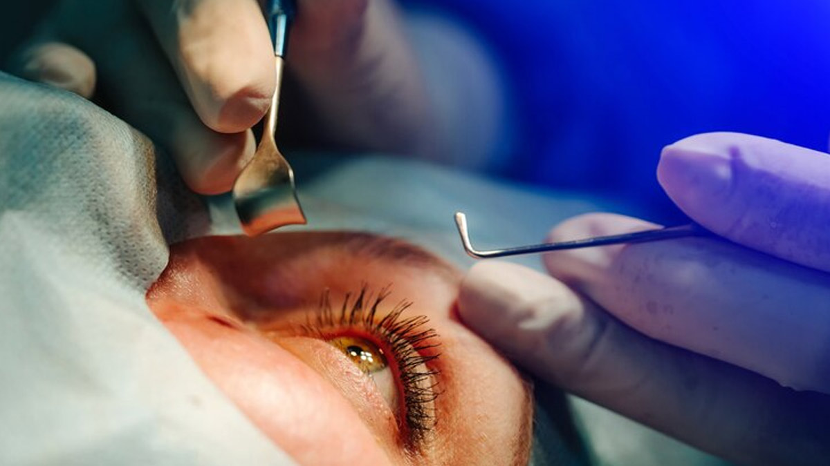 Confusion In Selecting The Right Lens After Cataract Surgery? Expert Lists Tips That Can Help