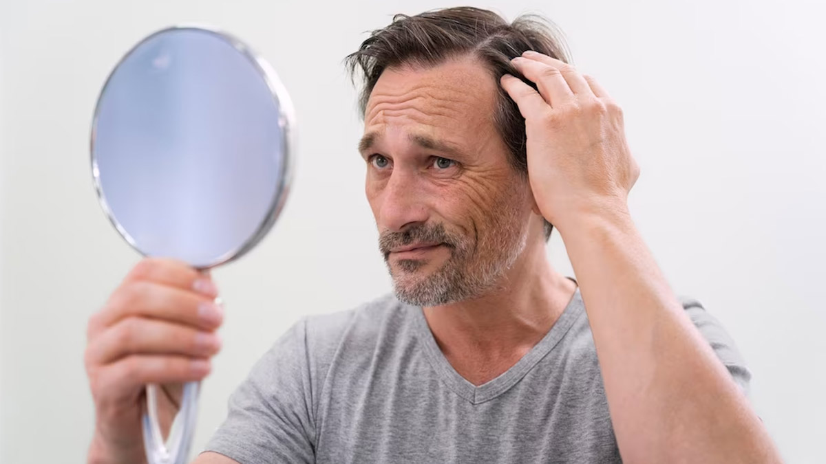 Hair Loss In Men: Daily Habits That Could Be Leading To It