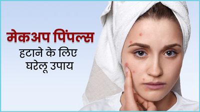मेकअप के कारण हो गए हैं चेहरे पर पिंपल्स? इन 5 घरेलू उपायों से पाएं छुटकारा