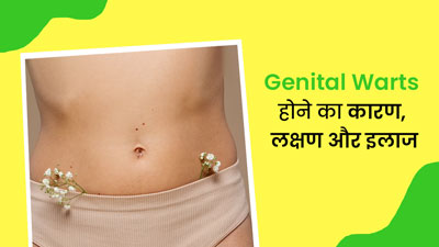 जननांग में मस्से (Genital Warts) होने के क्या कारण हो सकते हैं? डॉक्टर से जानें इसके लक्षण और इलाज