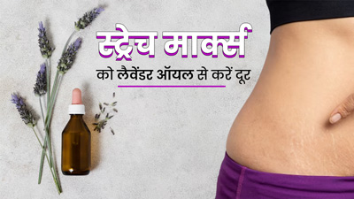 स्ट्रेच मार्क्स दूर करने में मदद करेगा लैवेंडर ऑयल, जानें इस्तेमाल का तरीका 