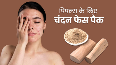 मुंहासों से छुटकारा पाने के लिए लगाएं चंदन के ये 3 फेस पैक, जानें बनाने का तरीका