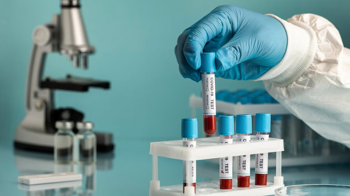 thalassemia lifestyle changes 
