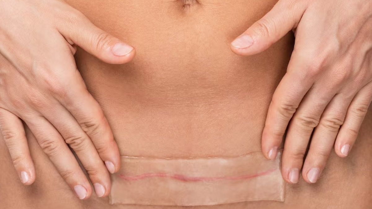 Post Delivery Care For First Time Mothers