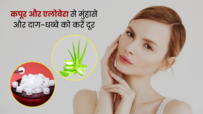 कपूर और एलोवेरा से दूर करें चेहरे के मुंहासे और दाग-धब्बे, जानें प्रयोग का तरीका