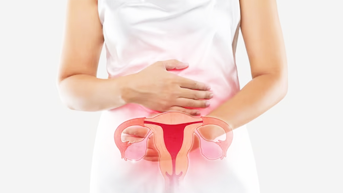 Can Pcos Come Back After Treatment