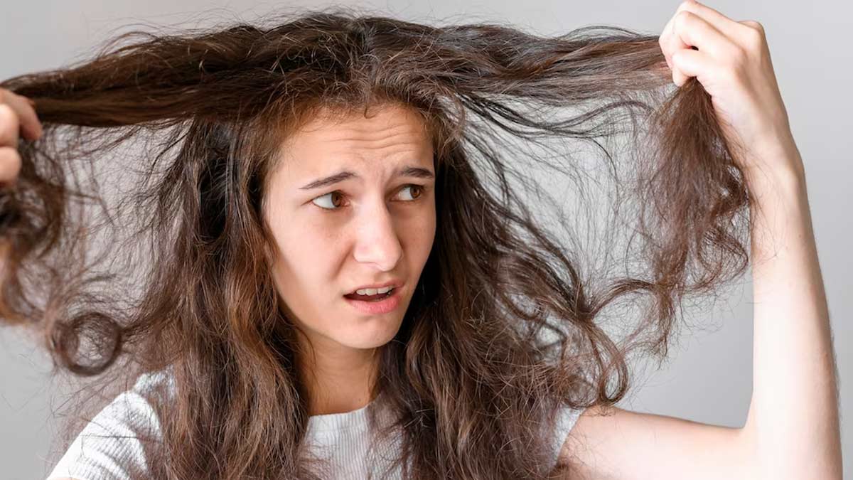 Dry And Damaged Hair? Here're 5 Homemade Conditioners You Can Try