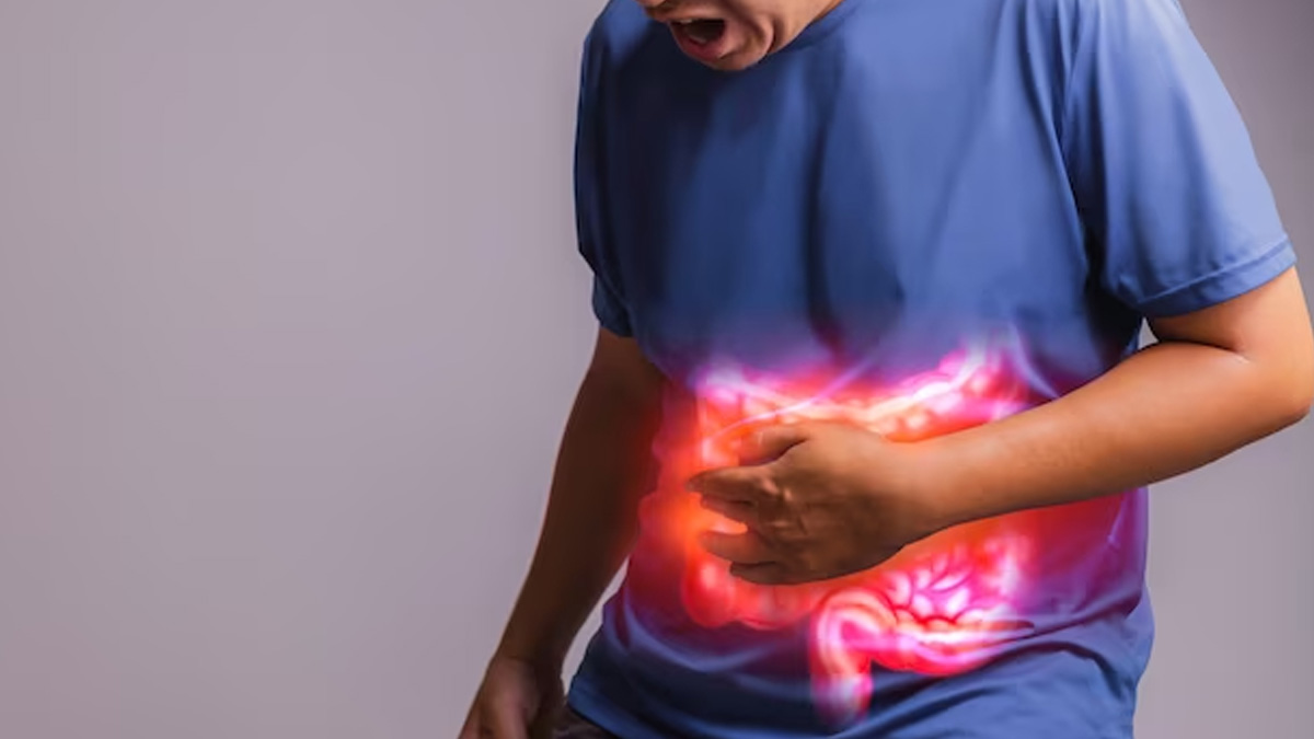 Dealing With Hernia? Expert Lists 6 Tips To Manage It 