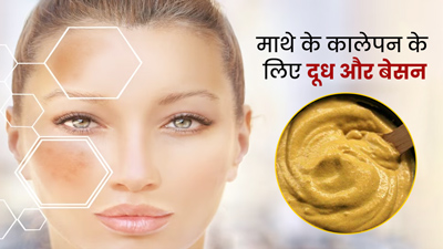 धूप की वजह से माथा हो गया है काला, तो डार्कनेस दूर करने के लिए लगाएं दूध और बेसन का पेस्ट
