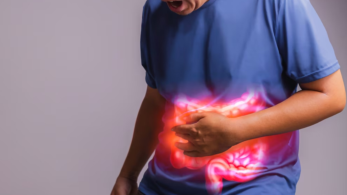 Causes Of Stomach Ulcer | Onlymyhealth