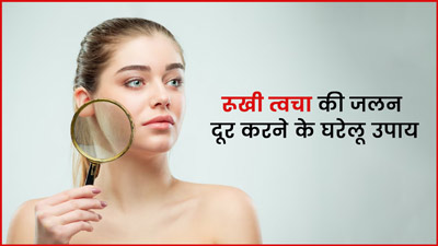 गर्मी में ड्राईनेस के कारण स्किन पर होती है जलन, दूर करने के लिए अपनाएं ये 5 घरेलू उपाय