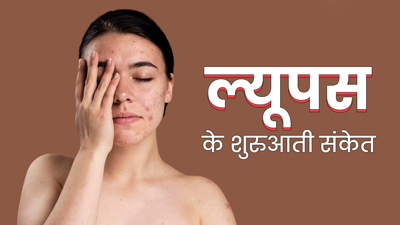 चेहरे और स्किन पर दिखने वाले ये लक्षण हो सकते हैं ल्यूपस का संकेत, जानें बचाव के उपाय