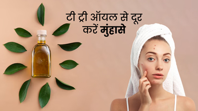 मुंहासे दूर करने के लिए इस तरह करें टी ट्री ऑयल का प्रयोग, दाग-धब्बे भी होंगे साफ