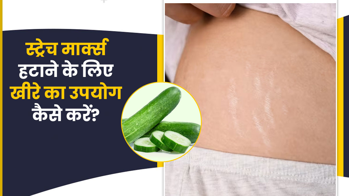 स्ट्रेच मार्क्स हटाने में मददगार हो सकता है खीरा, इन 4 तरीकों से करें इस्तेमाल