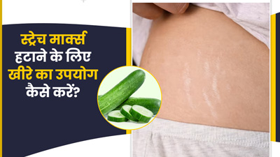 स्ट्रेच मार्क्स हटाने में मददगार हो सकता है खीरा, इन 4 तरीकों से करें इस्तेमाल