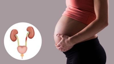 प्रेगनेंसी में यूटीआई से बचने के लिए खाएं ये फूड्स