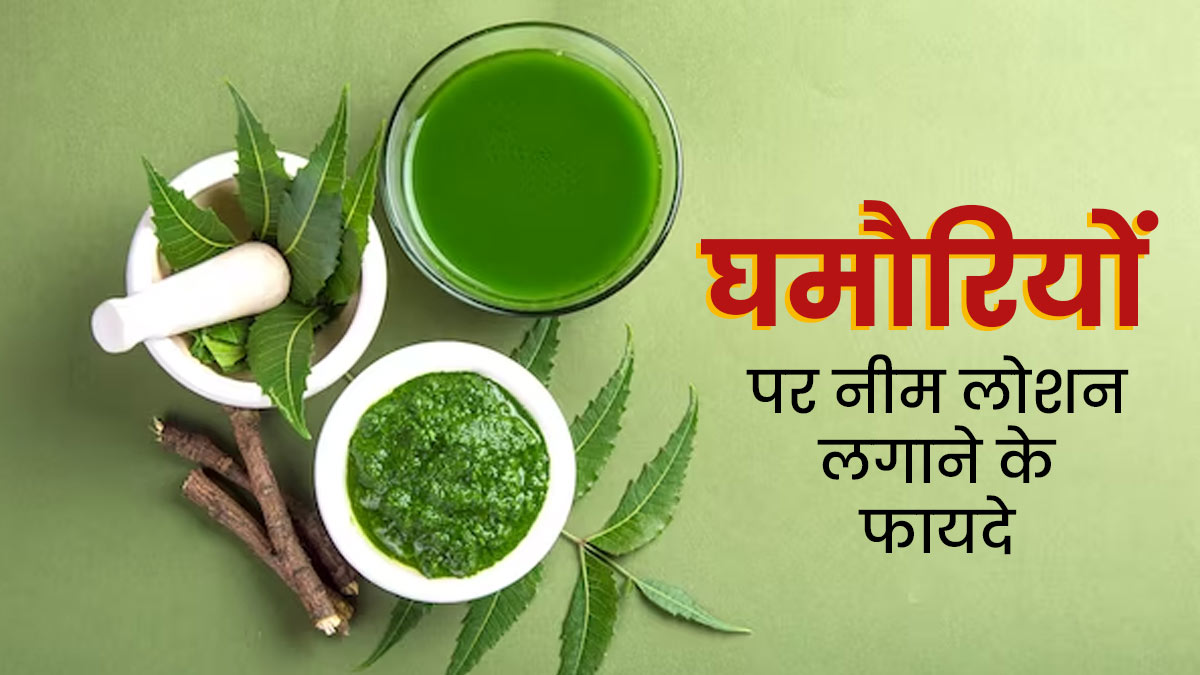 OMH Self Tried: गर्मी की घमौरियों के लिए मैंने घर पर बनाकर लगाया नीम का ये लोशन, आप भी करें ट्राई