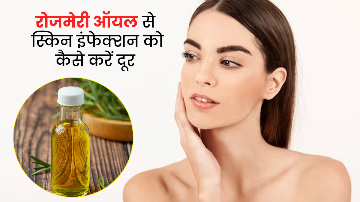 गर्मी में स्किन इंफेक्शन को ठीक कर सकता है रोजमेरी ऑयल, जानें इस्तेमाल का तरीका