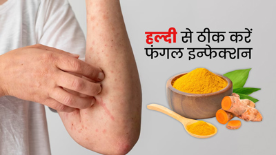 फंगल इन्फेक्शन का रामबाण इलाज है हल्दी, इस तरह करें इस्तेमाल
