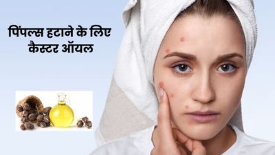 एक्ने और पिंपल्स से छुटकारा पाने के लिए ऐसे करें अरंडी के तेल का इस्तेमाल, मिलेगा फायदा