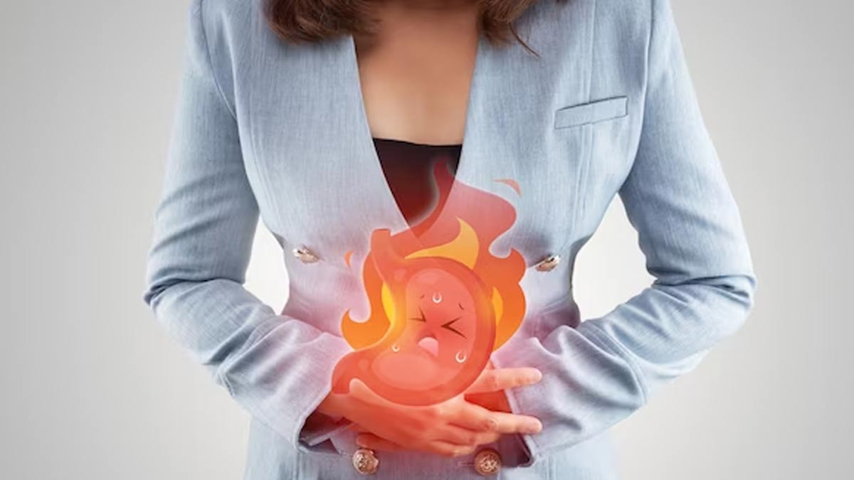 remedies for gas and acidity