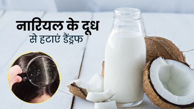 डैंड्रफ साफ करने के लिए इस तरह करें नारियल के दूध का प्रयोग, हेयर फॉल भी होगा कंट्रोल
