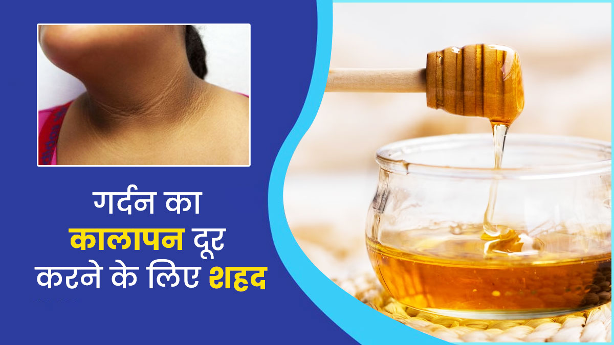 गर्दन का कालापन दूर करने के लिए इन 4 तरीकों से करें शहद का इस्तेमाल